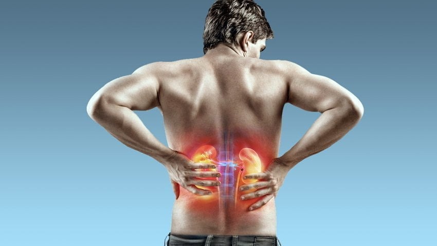 Cálculo renal: como prevenir?